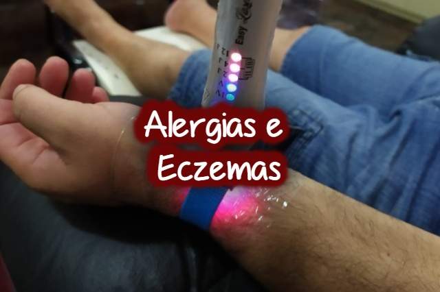Alergias e Eczemas