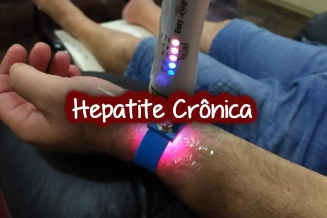 Hepatite Crônica